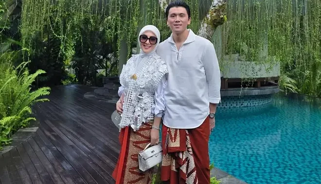 6 Gaya Anggun Hadiri Acara di Bali dengan Blus dan Outer Renda Putih